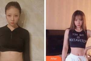 荊州美傲醫(yī)療美容診所徐國健整形價(jià)格表附微創(chuàng)疤痕修復(fù)案例展示