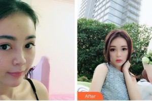 荊州市第二人民醫(yī)院整形激光美容中心雷濬嶸整形價(jià)格表附激光祛疤案例展示