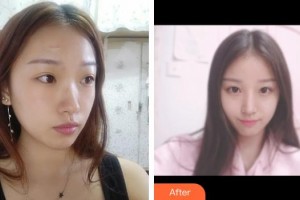 荊州名韓醫(yī)療美容診所李萍整形價(jià)格表附手術(shù)祛疤案例展示