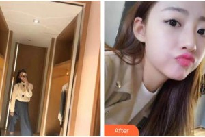 荊州沙市區(qū)楚星口腔門診部梁春紅整形價格表附牙齒隱形矯正案例展示