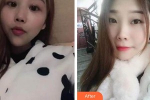 荊州沙市區(qū)楚星口腔門(mén)診部黃毅整形價(jià)格表附自鎖托槽矯正案例展示