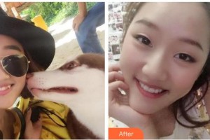 黃岡皓雅口腔醫(yī)院何秀坤整形價(jià)格表附牙齒隱形矯正案例展示