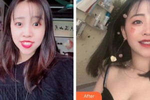 黃岡皓清口腔門診部聶文平整形價(jià)格表附金屬托槽矯正案例展示