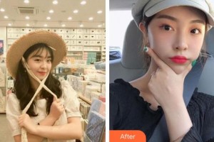 孝感仁愛(ài)醫(yī)院美容整形中心蔡光浩整形價(jià)格表附熱拉提案例展示