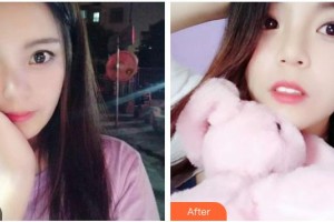 鄂州中山口腔醫(yī)院李順整形價格表附牙齒隱形矯正案例展示