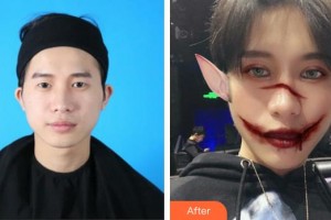 武漢艾格眼科醫(yī)院何荔軍整形價格表附眼部綜合案例展示