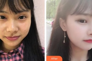 黃石愛(ài)爾眼科醫(yī)院田永宏整形價(jià)格表附埋線(xiàn)雙眼皮案例展示