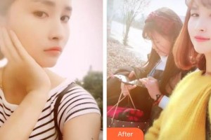 黃石中山口腔醫(yī)院郭計(jì)明整形價(jià)格表附美白劑美白牙齒案例展示