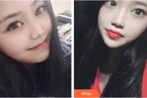 十堰安琪兒醫(yī)學(xué)美容門診部馬永奎整形價(jià)格表附熱拉提案例展示