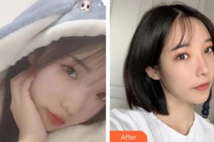 十堰愛爾眼科醫(yī)院戴鴻斌整形價(jià)格表附眼部綜合案例展示