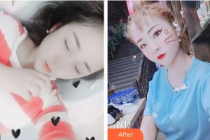 十堰愛爾眼科醫(yī)院翟坤顏整形價(jià)格表附眼部綜合案例展示