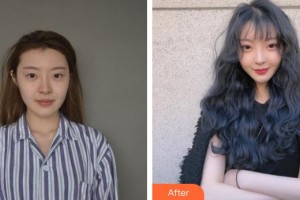 十堰愛爾眼科醫(yī)院王勇整形價(jià)格表附眼部修復(fù)案例展示