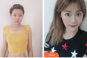 襄陽(yáng)海峽醫(yī)療美容門(mén)診部吳新建整形價(jià)格表附激光祛疤案例展示