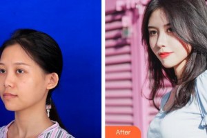 襄陽(yáng)維多利亞醫(yī)療美容醫(yī)院洪正秀整形價(jià)格表附鼻部綜合案例展示