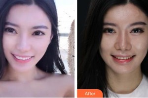 襄陽(yáng)伊萊美醫(yī)療美容醫(yī)院沈?qū)W洙整形價(jià)格表附美白貼片案例展示