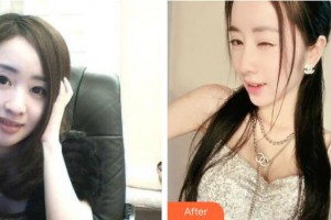 襄陽(yáng)韓素整形美容門(mén)診部周創(chuàng)業(yè)整形價(jià)格表附鼻部綜合案例展示