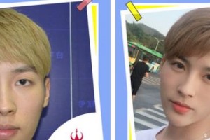 襄陽(yáng)伊爾美整形美容醫(yī)院劉妮娜整形價(jià)格表附自體脂肪墊下巴案例展示