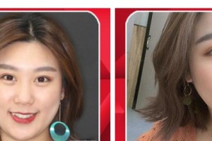 襄陽(yáng)牙牙口腔門診部李超宏整形價(jià)格表附隱形托槽矯正案例展示