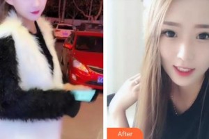 襄陽(yáng)維樂口腔門診部劉琴整形價(jià)格表附牙齒隱形矯正案例展示