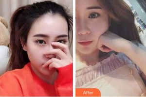 襄陽(yáng)牙牙口腔門診部馬煥整形價(jià)格表附牙齒隱形矯正案例展示