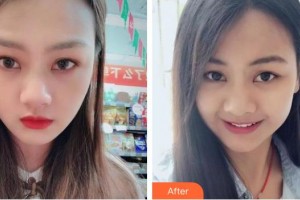 襄陽(yáng)維樂口腔門診部謝碧亨整形價(jià)格表附牙齒隱形矯正案例展示