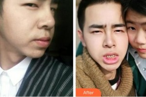 襄陽(yáng)牙美口腔門診部黃盛興整形價(jià)格表附冷光美白案例展示