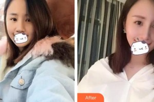 九江風(fēng)華醫(yī)療美容門(mén)診部李風(fēng)華整形價(jià)格表附膨體隆鼻案例展示