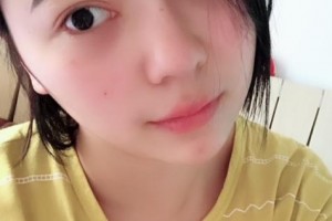 贛州亞韓醫(yī)療美容門診部金輝整形價(jià)格表附隆鼻案例展示