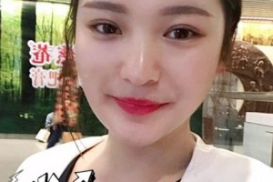 贛州啟明星眼科醫(yī)院鄧冬英整形價(jià)格表附眼部綜合案例展示