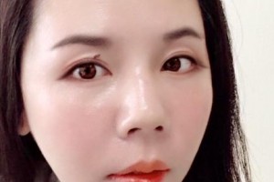 贛州衛(wèi)華口腔醫(yī)院盧衛(wèi)華整形價(jià)格表附口腔綜合案例展示