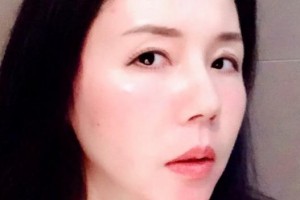 贛州華美醫(yī)療美容門診部牛先翠整形價(jià)格表附隆鼻案例展示