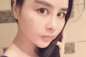 吉安天使醫(yī)療美容診所郭峰整形價格表附嫩膚案例展示