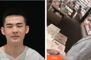 平頂山藝美醫(yī)療美容醫(yī)院張萍整形價格表附鼻部綜合案例展示