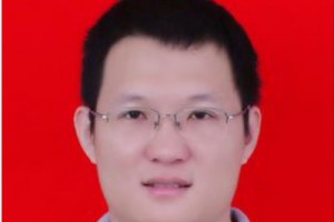 南方醫(yī)科大學(xué)南方醫(yī)院價(jià)格怎么樣杜本軍顴骨案例分享附價(jià)格一覽