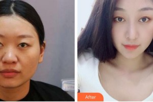 烏魯木齊時(shí)光醫(yī)療美容門診部馬龍整形價(jià)格表附鼻部綜合案例展示