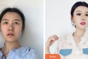 昆山博愛醫(yī)院整形美容中心林華整形價格表附眼部綜合案例展示