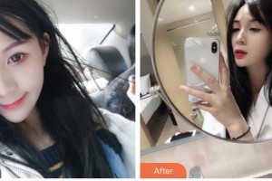 昆山百達麗醫(yī)療美容門診部劉瑩整形價格表附光子嫩膚案例展示