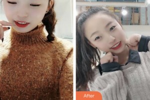 昆山杰齒口腔醫(yī)院蔣永林整形價格表附超聲波潔牙案例展示