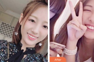 昆山杰齒口腔醫(yī)院翁雨來整形價格表附牙齒隱形矯正案例展示