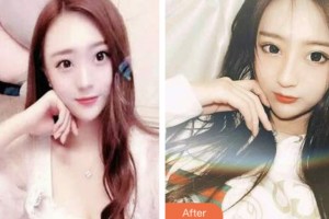 昆山益達(dá)口腔門診部萬東元整形價格表附超聲波潔牙案例展示