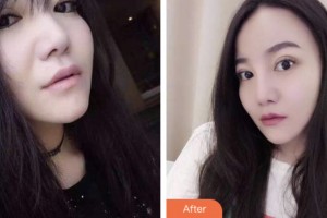 昆山益達(dá)口腔門診部朱肖蒙整形價格表附牙齒隱形矯正案例展示