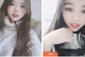 昆山拜博口腔門診部邊俊杰整形價格表附超聲波潔牙案例展示