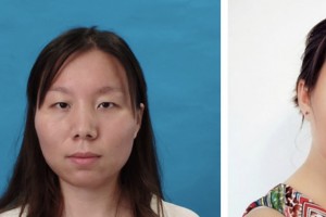 鹽城東方婦產(chǎn)醫(yī)院整形美容中心方長亮整形價格表附切開雙眼皮案例展示