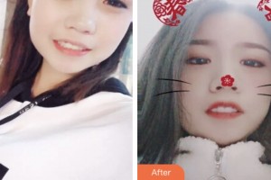 鹽城口腔醫(yī)院劉正彤整形價格表附冷光美白案例展示