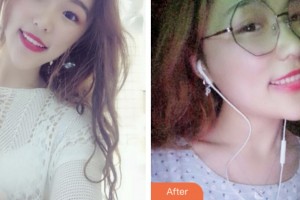 鹽城倍美永康口腔門診部高麗整形價格表附冷光美白案例展示