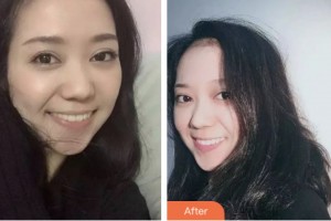 鹽城倍美永康口腔門診部呂利松整形價格表附牙齒隱形矯正案例展示