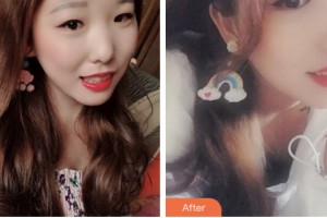 淮安諾貝爾口腔醫(yī)院孫瑞祥整形價格表附牙齒隱形矯正案例展示