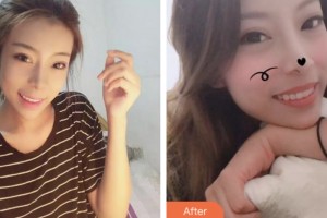 荊門小白兔口腔醫(yī)院王軍新整形價格表附牙齒隱形矯正案例展示