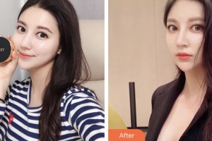 株洲嘉美醫(yī)療整形美容診所張賓整形價格表附鼻部綜合案例展示