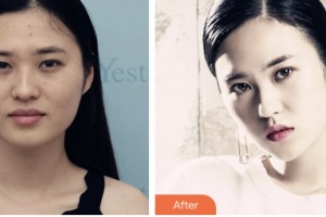 株洲韓美醫(yī)療美容醫(yī)院胡明科整形價格表附鼻部綜合案例展示